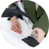 un tratamiento láser de eliminación de tatuajes