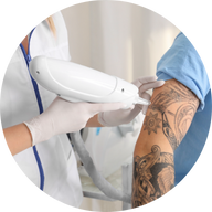 un tratamiento láser de eliminación de tatuajes